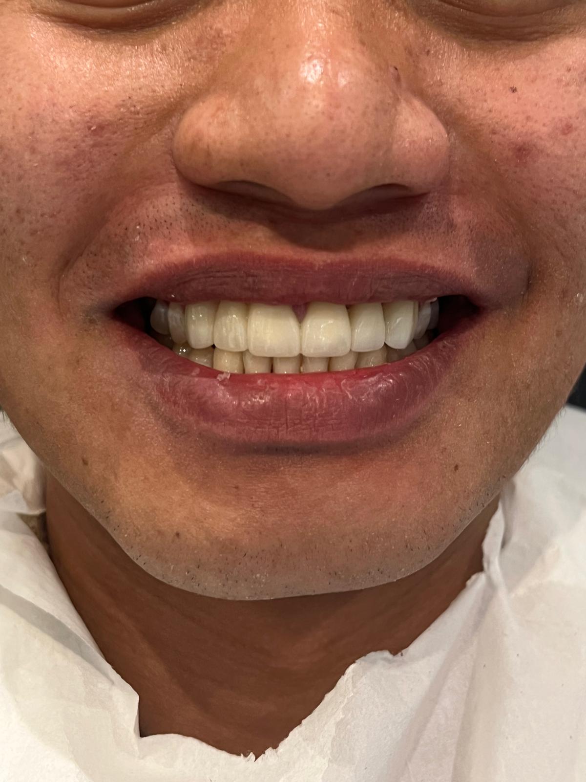 ECE Dental Patient Transformation